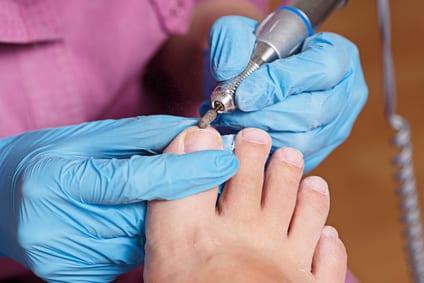 Certified nurse performing diabetic foot care treatment on a patient