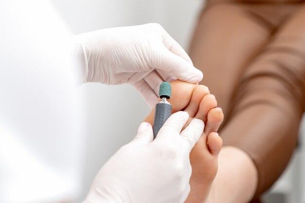 Gloved nurse using an electric grinding tool for safe diabetic nail treatment